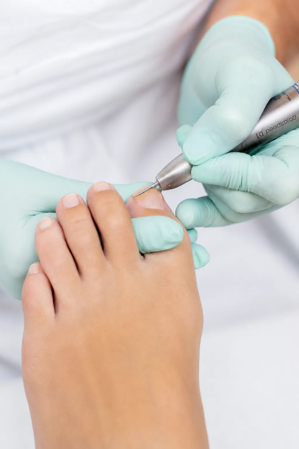 Pedicure herstelt een grote teennagel met een elektrisch precisie-instrument.